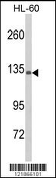 C5 Antibody (N-term)
