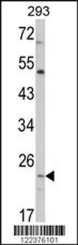 ATP5O Antibody (N-term)