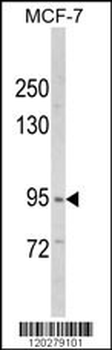 VPS53 Antibody (N-term)