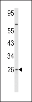 IFNB1 Antibody (N-term)