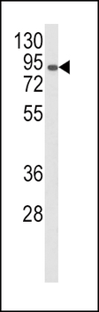 AOC3 Antibody (Center)