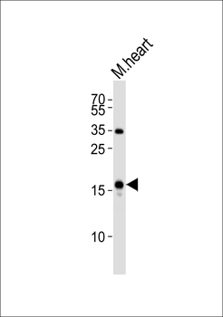 NPPA Antibody (N-term)