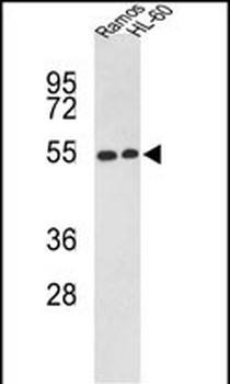 NR1H2 Antibody (N-term)