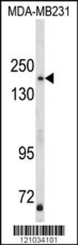 TBC1D4 Antibody (N-term)