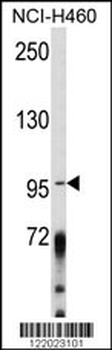 AKAP3 Antibody (Center)