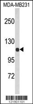 ACTN1 Antibody (N-term)