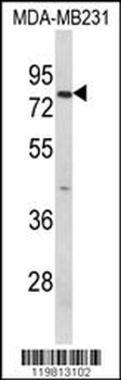 RANBP9 Antibody (Center)