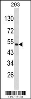 CKIP-1 Antibody (N-term)
