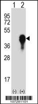 R MKP3 Antibody