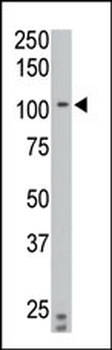 PTPIA2 beta Antibody (N-term)