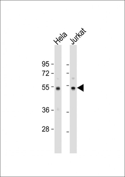 PTP1B Antibody