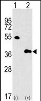 GBL Antibody (Center)