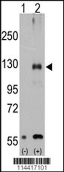 TRPM8 Antibody (Center R536)
