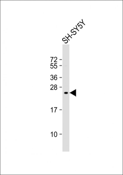 KIP2 Antibody (N-term)