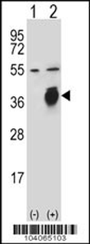PLAUR Antibody (Center)