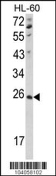 NME4 Antibody (C-term)