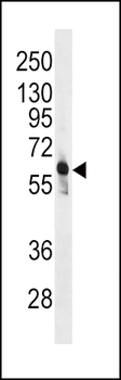 PFKFB3 Antibody (C-term)