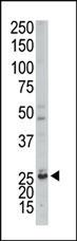 AK3 Antibody (C-term H38)