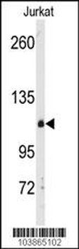 DGKD Antibody (C-term)