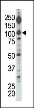 Diacylglycerol kinase iota (DGKI) Antibody (C-term)