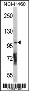 DGKQ Antibody (C-term)