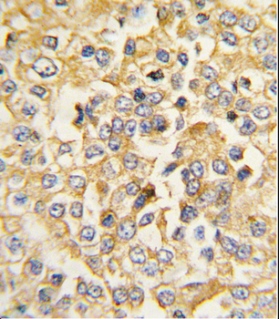 Natriuretic Peptide Receptor A Antibody (N-term)
