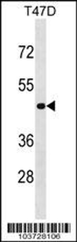 NME7 Antibody (N-term)