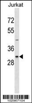 NEK7 Antibody (N-term)