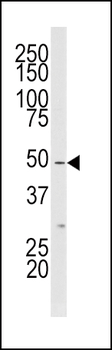 MLKLAK Antibody (Center)