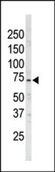 ARK5 Antibody (N-term)