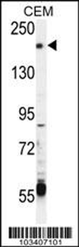 TRPM6 (CHAK2) Antibody (Center)