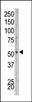 PIP5K2B Antibody (N-term)