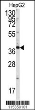 Endophilin B1 Antibody (Y80)