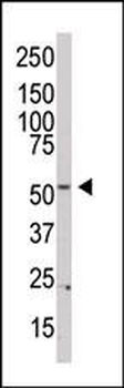 PI 4 Kinase type 2 beta antibody (N-term)