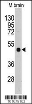 PI4K2A (PI4K II) Antibody (N-term)
