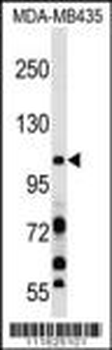 PIK3CB Antibody (N-term S139)