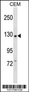 PI3KCB Antibody (C-term)