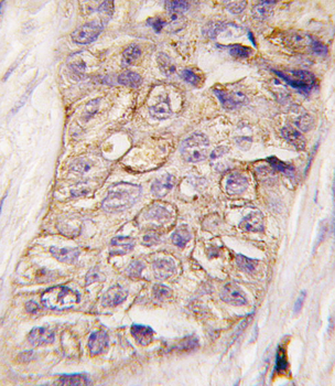 PI3KC2B Antibody (N-term)