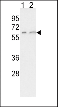 CYP7A1 Antibody (C-term)
