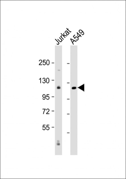 NIK Antibody (Center)