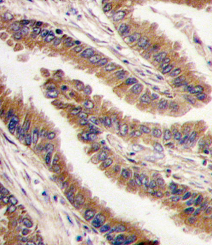 PRKX Antibody (C-term)