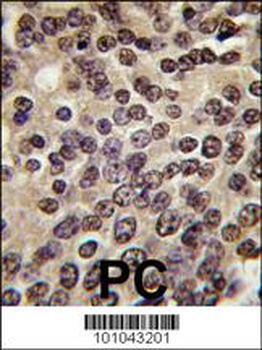 PKN beta Antibody (C-term)