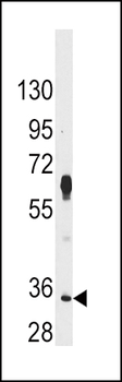 PIM2 Antibody (C-term)