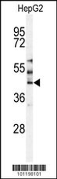 MST3 Antibody (C-term)