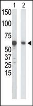 GCK Antibody (N-term)