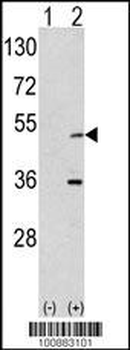 AIK Antibody (N-term)
