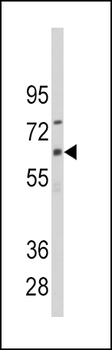 CYP1B1 Antibody (Center)