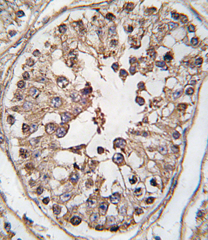 TBK1 Antibody (S172)