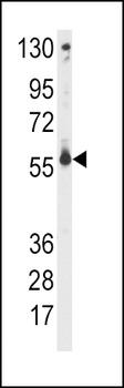CYP2C9 Antibody (Center)
