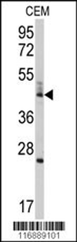 BCL2L13 Antibody (Center)